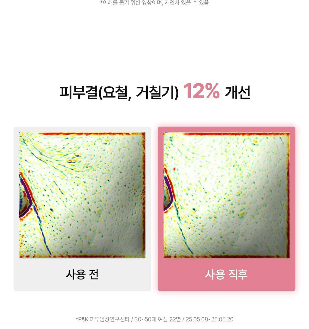 [1+1/유혜주PICK] 바이오던스 포어 퍼펙팅 콜라겐 펩타이드 세럼 30ml 더블 기획 상세페이지 26